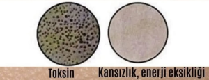 Explanation of skin discoloration and temporary cupping marks after cupping therapy (second image)