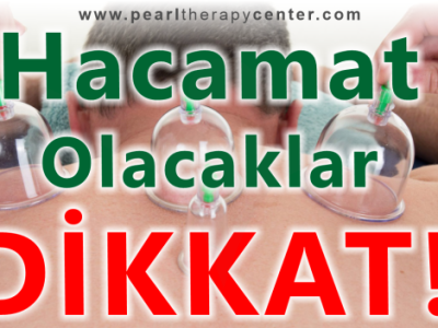 CUPPING – Hijama – Wet Cupping