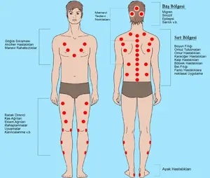 Pearl Therapy cupping points and appropriate wet cupping application areas for the individual.