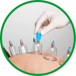 CUPPING – Hijama – Natte cupping
