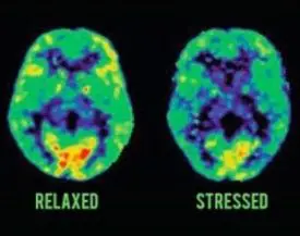 the effect of stress on the brain